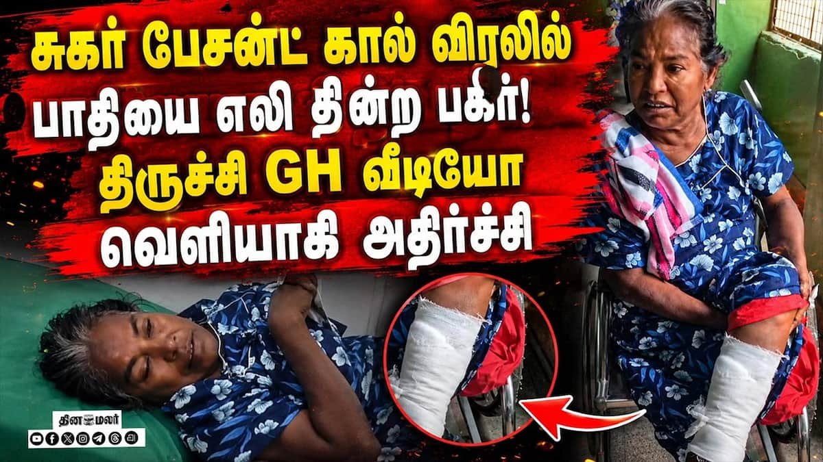 திருச்சி அரசு மருத்துவமனையில் எலி கடி விவகாரம்: வைரலான வீடியோ பரபரப்பு