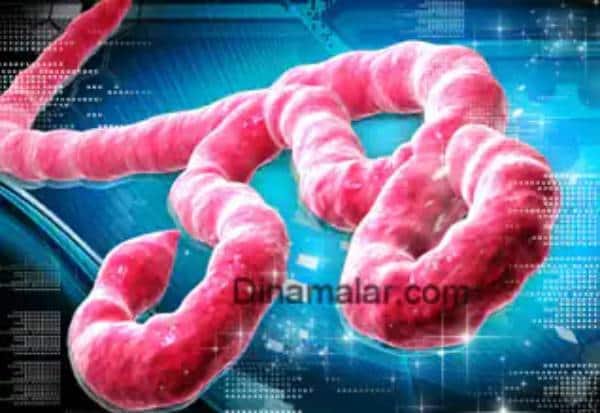 WHO declares Ebola outbreak in Congo, Uganda a health emergency